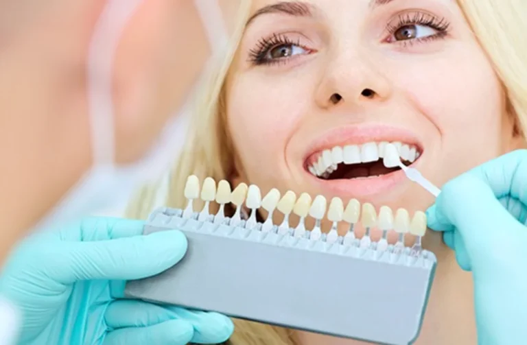 Common Smile Problems a Cosmetic Dentist in Edison Can Fix