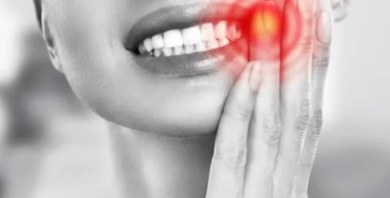Managing Toothaches Safe and Effective Over-the-Counter Options