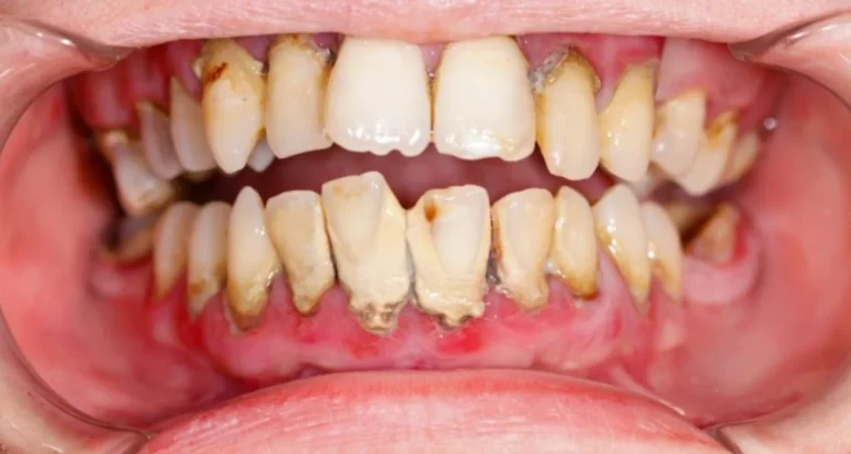 Common Dental Problems People in White Rock