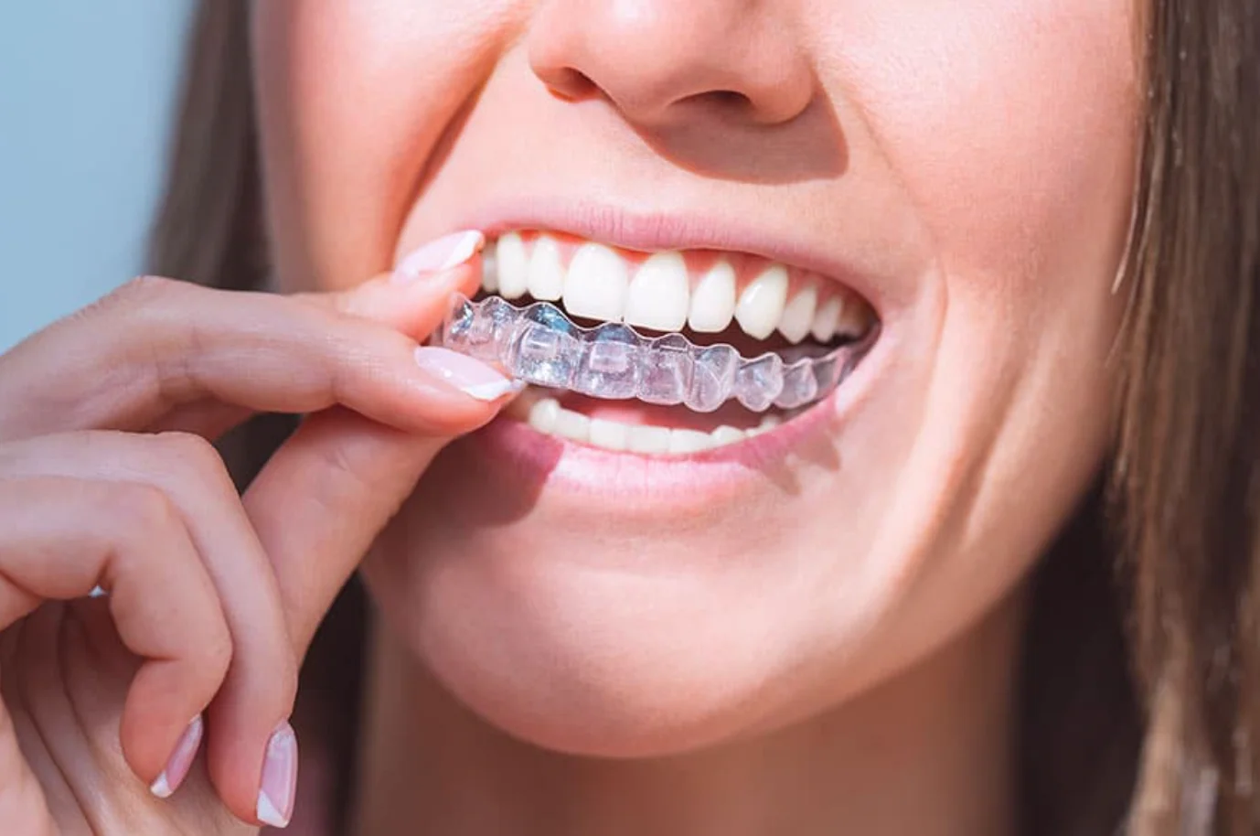 7 Health Habits That Make Clear Aligner Treatment Work Better for Adults